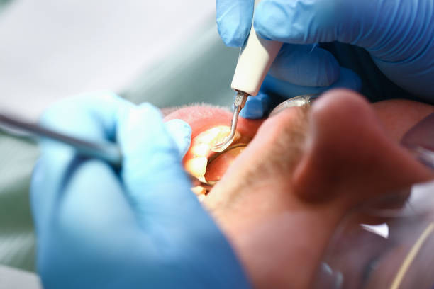 Best Emergency Gum Treatment in Pecatonica, IL